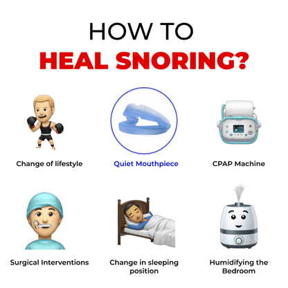 Honex™ The Quiet Anti-Snoring Mouthpiece Universal Size